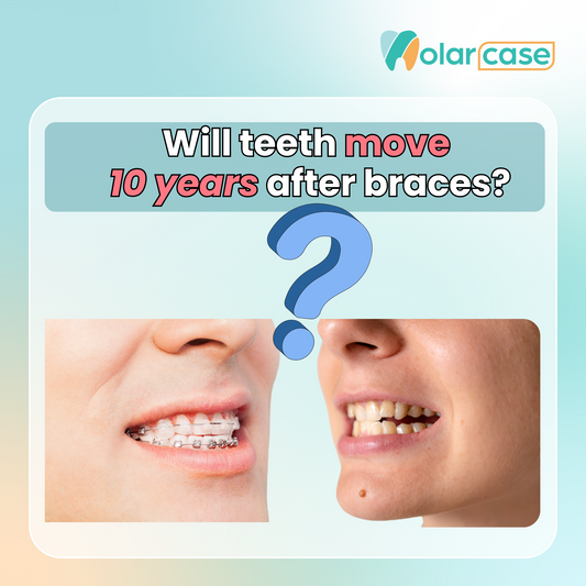 Will teeth move 10 years after braces? | Molarcase.com