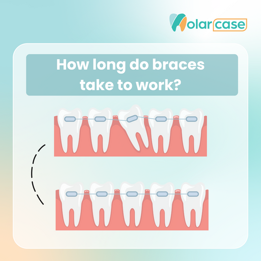 How Quickly Do Braces Start Working? | Molarcase.com